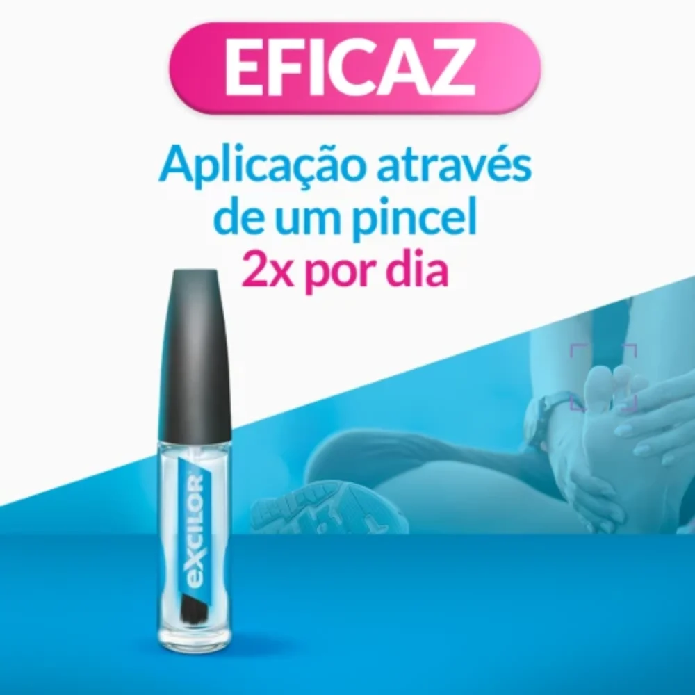 Excilor Solution for Fungal Nail Infections