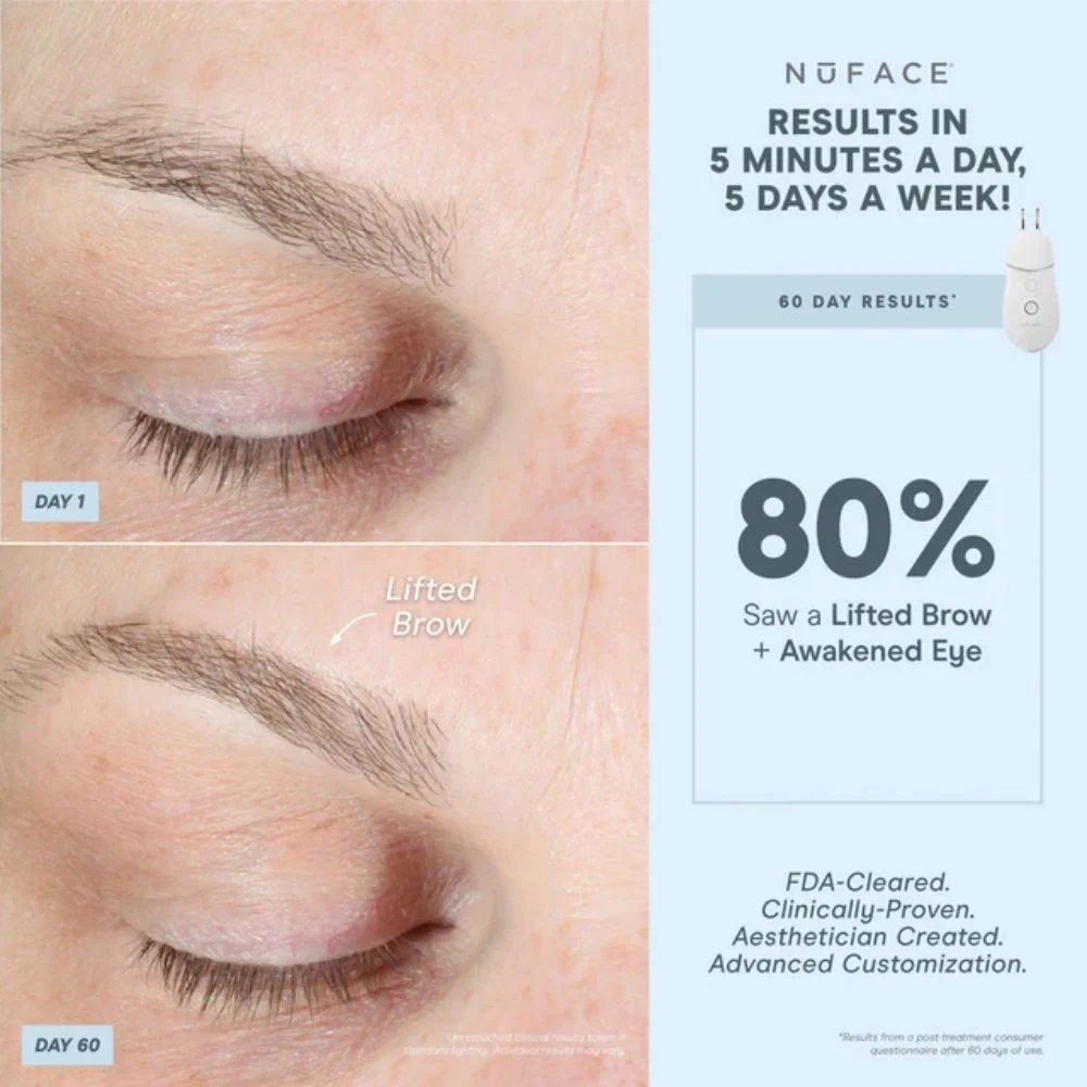 Nuface Trinity+ Lip & Eye Attachment