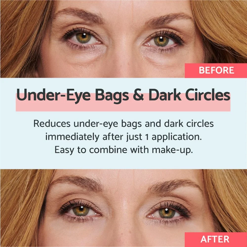 Remescar Eye Bags and Dark Circles Immediate Results