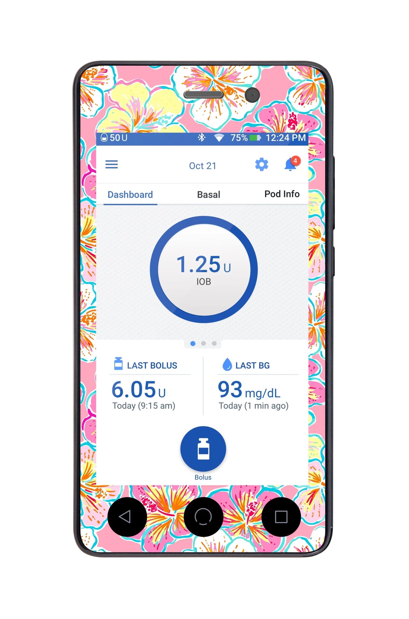 Tropic Crush Sticker for Omnipod DASH PDM – Pump Peelz